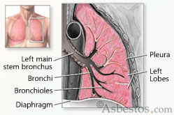 Asbestos.com Lung Diagram